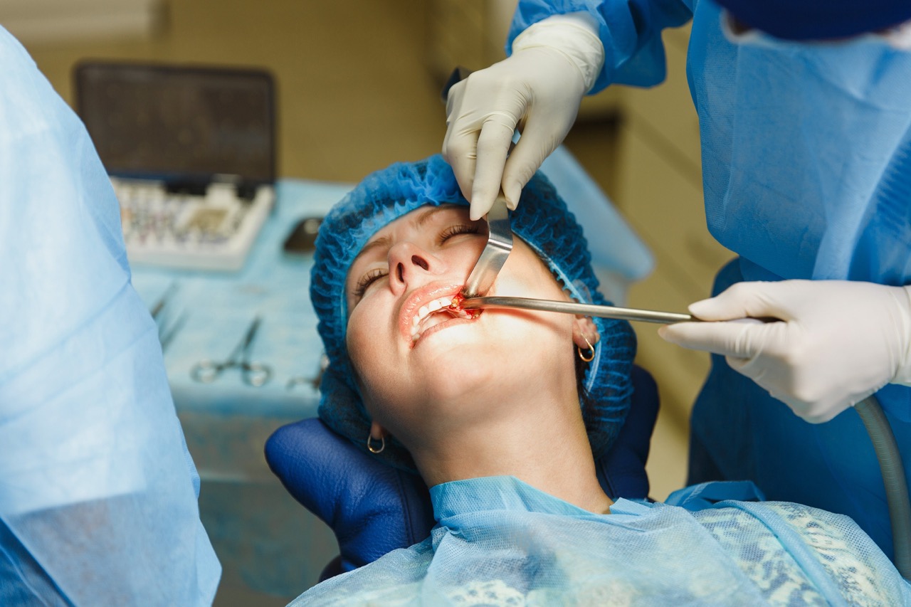 Chirurgia a dentoalveolárna chirurgia
